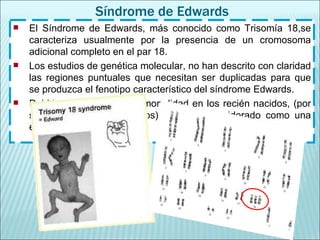 Síndrome de Edwards El Síndrome de Edwards, más conocido como Trisomía 18,se caracteriza usualmente por la presencia de un cromosoma adicional completo en el par 18.  Los estudios de genética molecular, no han descrito con claridad las regiones puntuales que necesitan ser duplicadas para que se produzca el fenotipo característico del síndrome Edwards. Debido a su alta tasa de mortalidad en los recién nacidos, (por sobre el 90% de los casos) se le ha considerado como una enfermedad de tipo “letal”. 