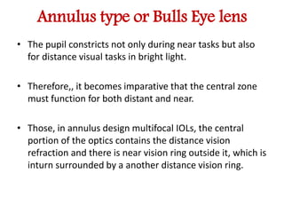 Mutifocal iols | PPTX
