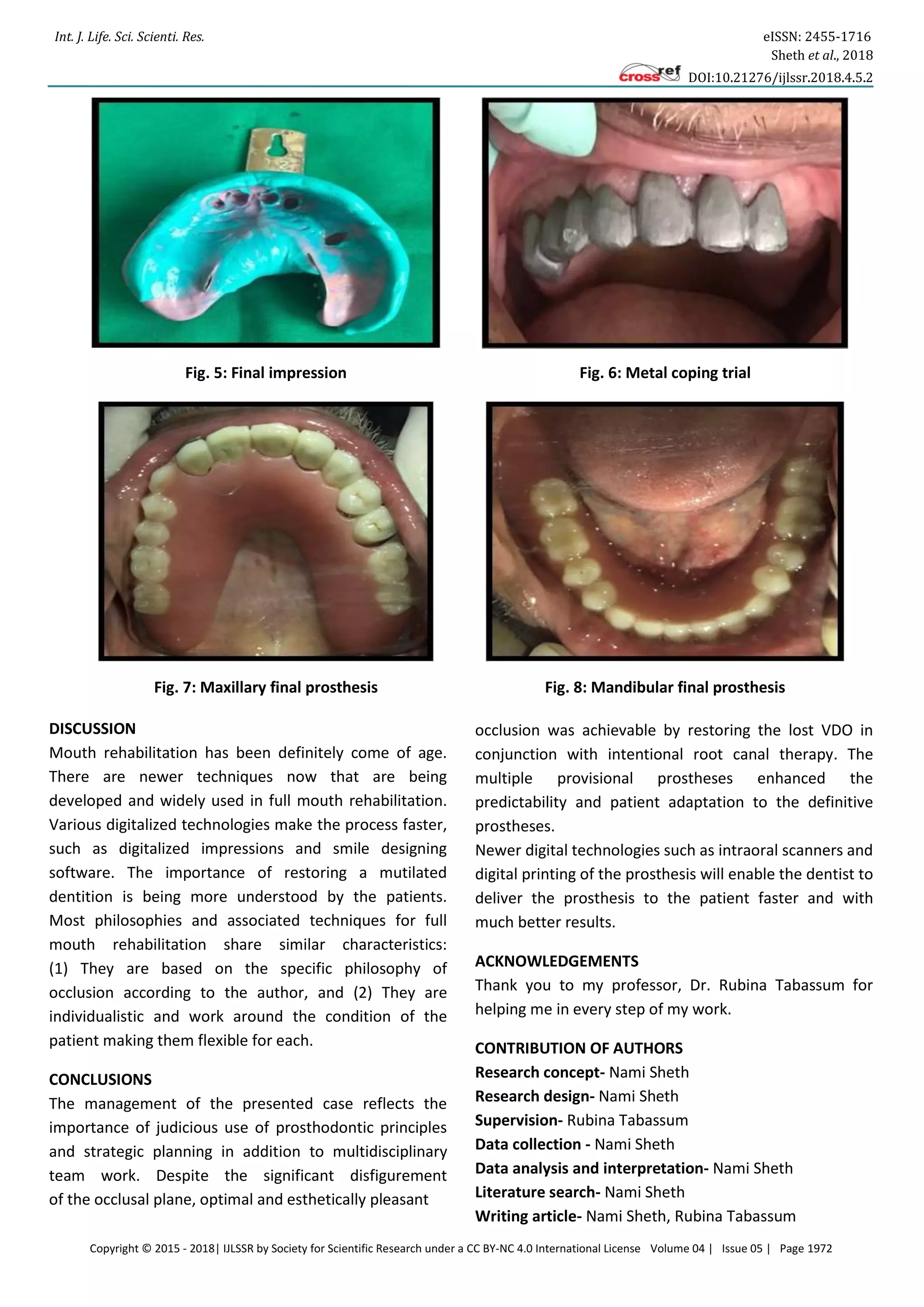 Int. J. Life. Sci. Scienti. Res. eISSN: 2455-1716
Sheth et al., 2018
DOI:10.21276/ijlssr.2018.4.5.2
Copyright © 2015 - 2018| IJLSSR by Society for Scientific Research under a CC BY-NC 4.0 International License Volume 04 | Issue 05 | Page 1972
Fig. 5: Final impression Fig. 6: Metal coping trial
Fig. 7: Maxillary final prosthesis Fig. 8: Mandibular final prosthesis
DISCUSSION
Mouth rehabilitation has been definitely come of age.
There are newer techniques now that are being
developed and widely used in full mouth rehabilitation.
Various digitalized technologies make the process faster,
such as digitalized impressions and smile designing
software. The importance of restoring a mutilated
dentition is being more understood by the patients.
Most philosophies and associated techniques for full
mouth rehabilitation share similar characteristics:
(1) They are based on the specific philosophy of
occlusion according to the author, and (2) They are
individualistic and work around the condition of the
patient making them flexible for each.
CONCLUSIONS
The management of the presented case reflects the
importance of judicious use of prosthodontic principles
and strategic planning in addition to multidisciplinary
team work. Despite the significant disfigurement
of the occlusal plane, optimal and esthetically pleasant
occlusion was achievable by restoring the lost VDO in
conjunction with intentional root canal therapy. The
multiple provisional prostheses enhanced the
predictability and patient adaptation to the definitive
prostheses.
Newer digital technologies such as intraoral scanners and
digital printing of the prosthesis will enable the dentist to
deliver the prosthesis to the patient faster and with
much better results.
ACKNOWLEDGEMENTS
Thank you to my professor, Dr. Rubina Tabassum for
helping me in every step of my work.
CONTRIBUTION OF AUTHORS
Research concept- Nami Sheth
Research design- Nami Sheth
Supervision- Rubina Tabassum
Data collection - Nami Sheth
Data analysis and interpretation- Nami Sheth
Literature search- Nami Sheth
Writing article- Nami Sheth, Rubina Tabassum
 