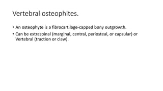 Vertebral osteophites.
• An osteophyte is a fibrocartilage-capped bony outgrowth.
• Can be extraspinal (marginal, central, periosteal, or capsular) or
Vertebral (traction or claw).
 