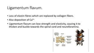 Ligamentum flavum.
• Loss of elastin fibres which are replaced by collagen fibers.
• Also deposition of Ca2+.
• Ligamentum flavum can lose strength and elasticity, causing it to
thicken and buckle towards the spinal cord and neuroforamina.
 