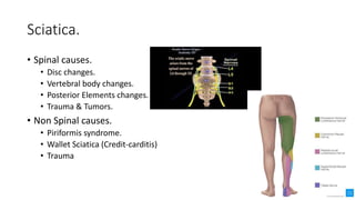 Sciatica.
• Spinal causes.
• Disc changes.
• Vertebral body changes.
• Posterior Elements changes.
• Trauma & Tumors.
• Non Spinal causes.
• Piriformis syndrome.
• Wallet Sciatica (Credit-carditis)
• Trauma
 