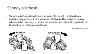 Spondylolisthesis
• Spondylolisthesis (also known as anterolisthesis) is defined as an
anterior displacement of a vertebra relative to the vertebra below,
whereas the reverse, i.e. when the superior vertebra slips posterior to
that below, is called retrolisthesis
(Butt and Saifuddin 2005).
 