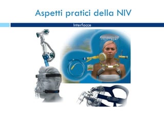 Aspetti pratici della NIV Interfacce 