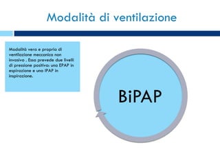 Modalità di ventilazione Modalità vera e propria di ventilazione meccanica non invasiva . Essa prevede due livelli di pressione positiva: una EPAP in espirazione e una IPAP in inspirazione. 