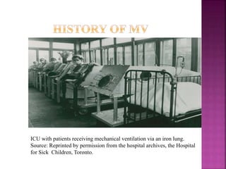 ICU with patients receiving mechanical ventilation via an iron lung.
Source: Reprinted by permission from the hospital archives, the Hospital
for Sick Children, Toronto.
 
