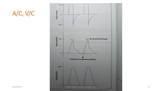 A/C, V/C
2/23/2019 Department of Anesthesiology, KCH 12
 
