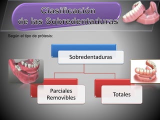 Según el tipo de prótesis:
Sobredentaduras
Parciales
Removibles
Totales
 