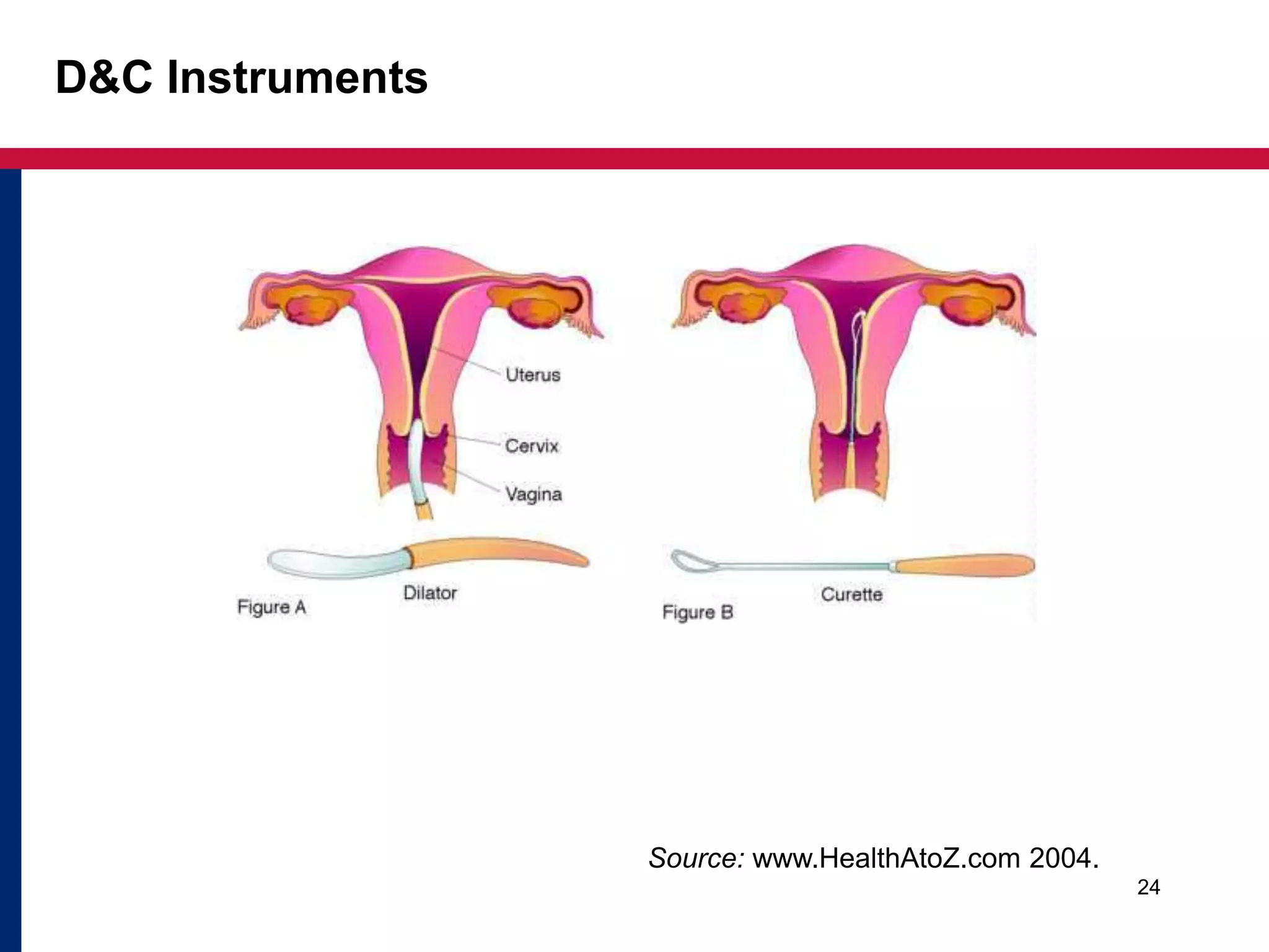 D&C Instruments 
24 
Source: www.HealthAtoZ.com 2004. 
 