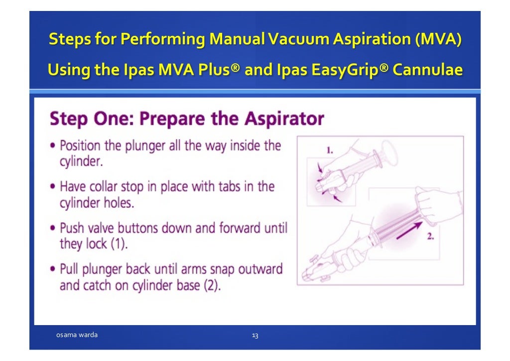 MANUAL VACUUM ASPIRATION