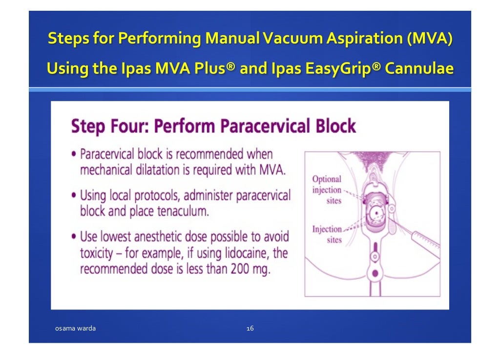 MANUAL VACUUM ASPIRATION