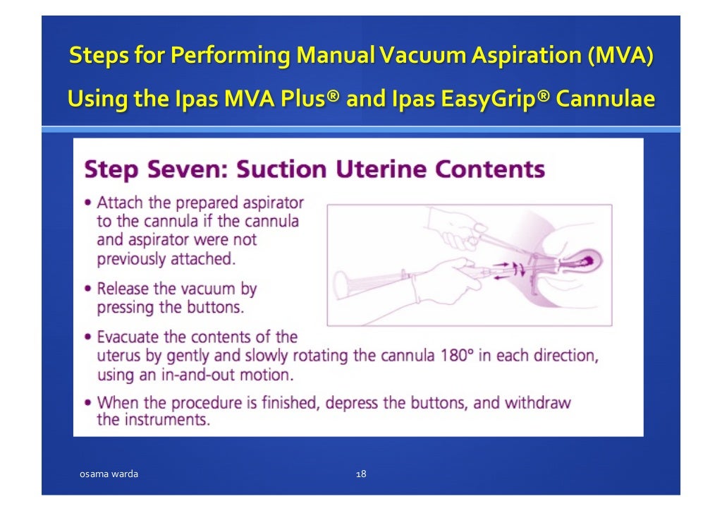 MANUAL VACUUM ASPIRATION