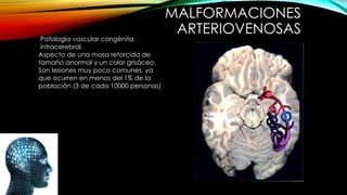 MALFORMACIONES
ARTERIOVENOSAS
Patología vascular congénita
intracerebral.
Aspecto de una masa retorcida de
tamaño anormal y un color grisáceo.
Son lesiones muy poco comunes, ya
que ocurren en menos del 1% de la
población (3 de cada 10000 personas)