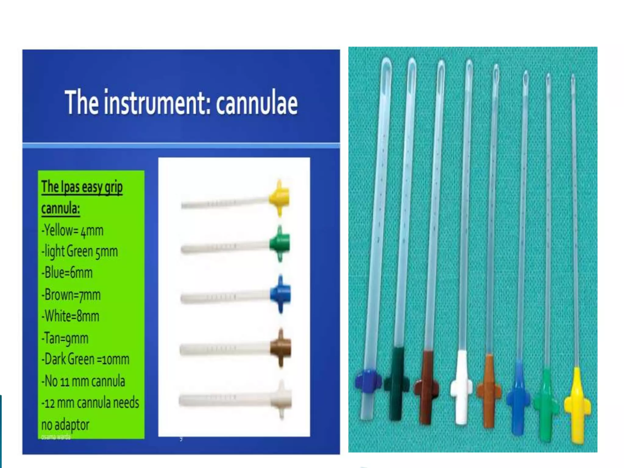 Manual vacuum aspiration | PPTX