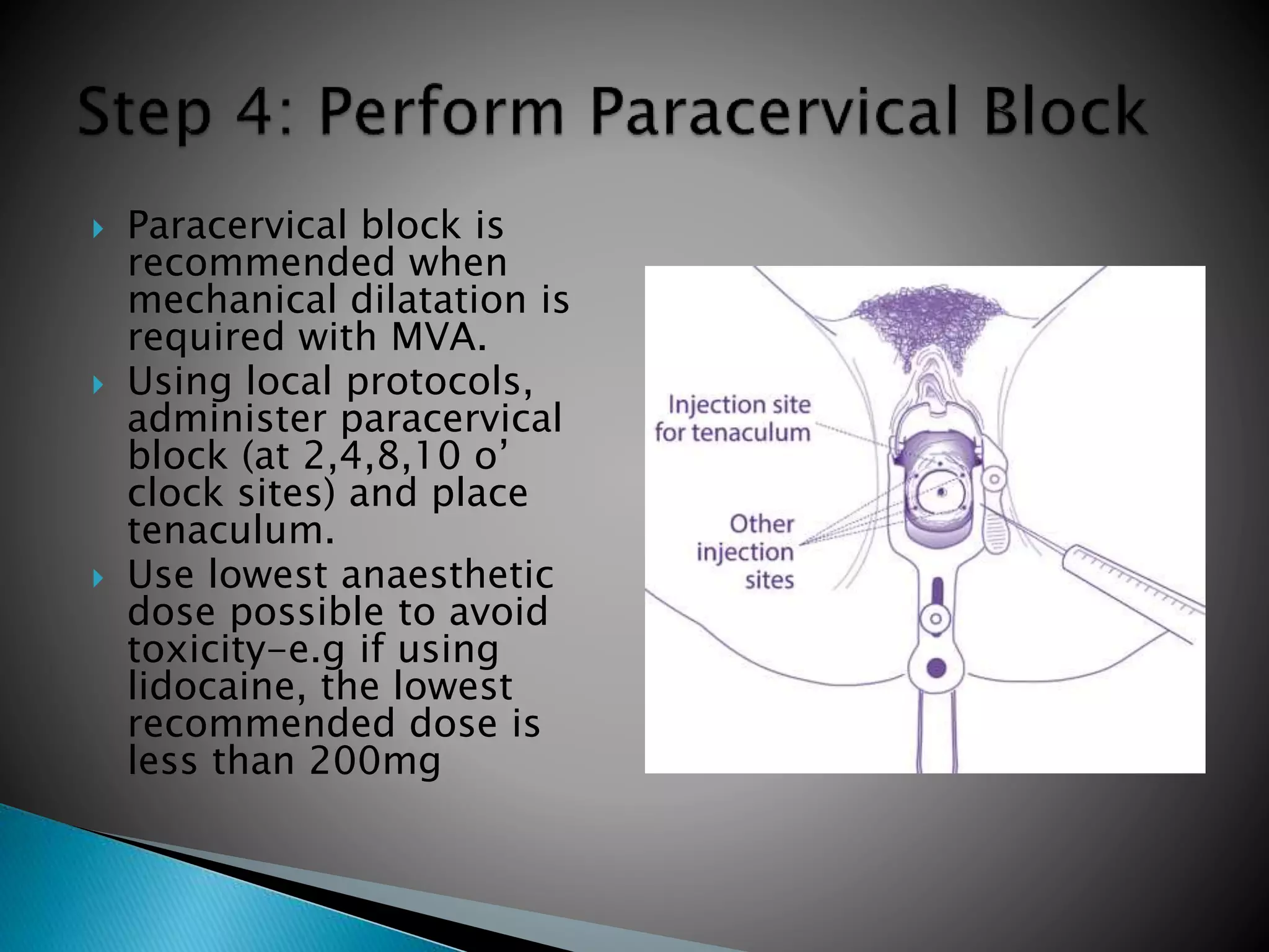 Paracervical Injection Manual vacuum aspiration | PPTX
