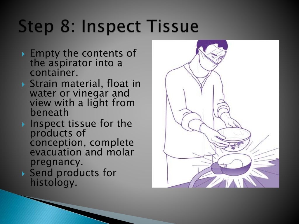 Manual vacuum aspiration