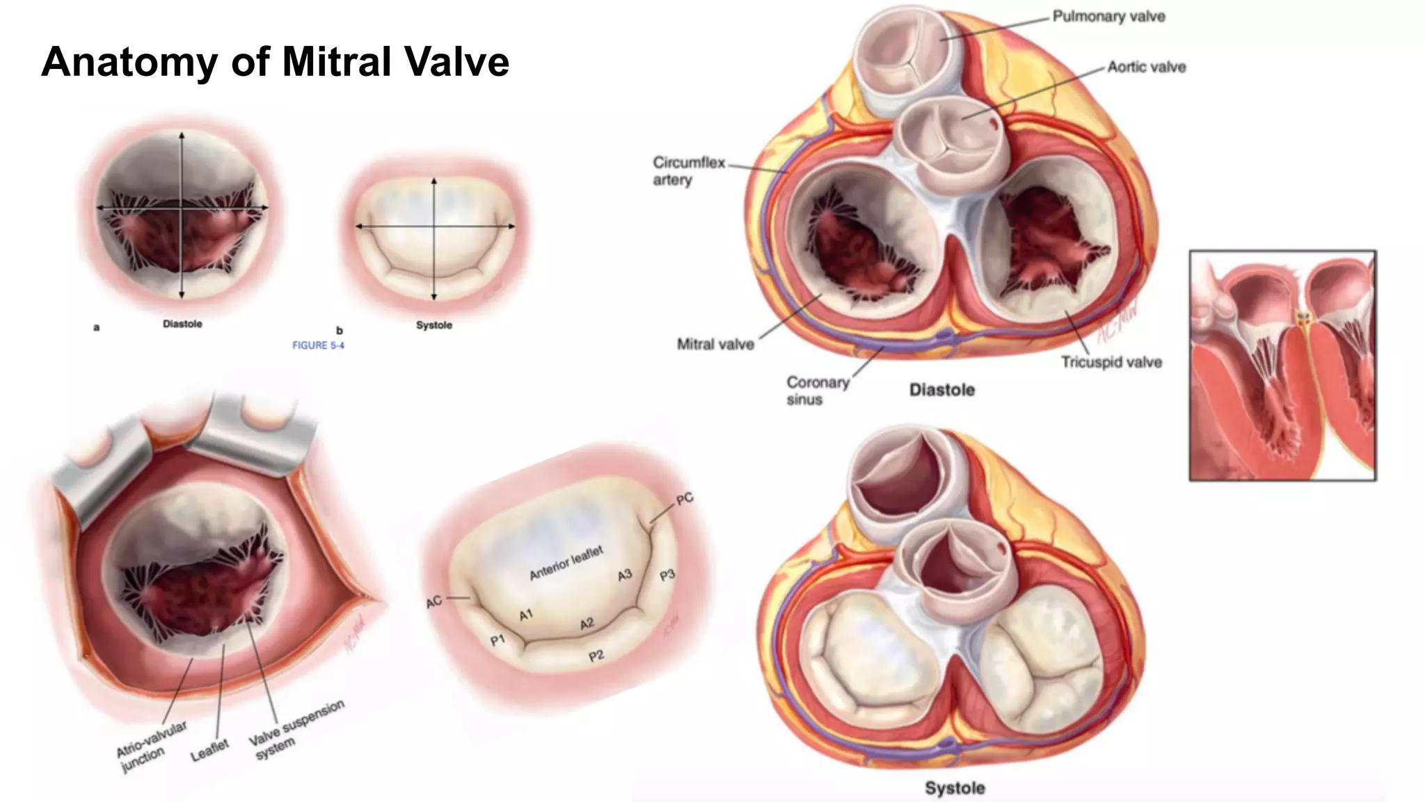 Echocardiography Of Mitral Valve Surgeons Perspective PDF