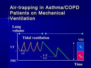 Tidal ventilation
Lung
volume
VT
FRC
VT
VEE
Time
VEI
I :E
1:1
I : E
1: 6
Air-trapping in Asthma/COPDAir-trapping in Asthma/COPD
Patients on MechanicalPatients on Mechanical
VentilationVentilation
 