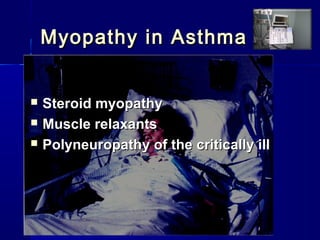 Myopathy in AsthmaMyopathy in Asthma
 Steroid myopathySteroid myopathy
 Muscle relaxantsMuscle relaxants
 Polyneuropathy of the critically illPolyneuropathy of the critically ill
 