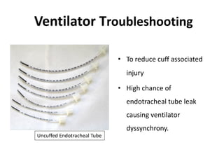 Ventilator Troubleshooting
• To reduce cuff associated
injury
• High chance of
endotracheal tube leak
causing ventilator
dyssynchrony.
Uncuffed Endotracheal Tube
 