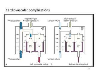 Cardiovascular complications
–Reduced cardiac output
Oxygen toxicity
–High FIO2 levels that have been applied for an extended period may
result in tissue injury that alters lung function and gas distribution
–Retinopathy of prematurity
Hypoventilation, hyperventilation
–Disconnection from the ventilator and unplanned extubation
–High impedance to inflation
–“Operator error” in establishing ventilation
23
 