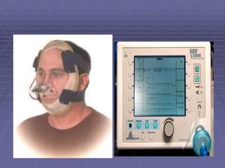 Mechanical Ventilator