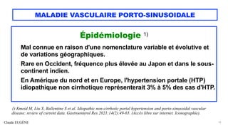 Claude EUGÈNE
MALADIE VASCULAIRE PORTO-SINUSOIDALE
Épidémiologie 1)
Mal connue en raison d'une nomenclature variable et évolutive et
de variations géographiques.
Rare en Occident, fréquence plus élevée au Japon et dans le sous-
continent indien.
En Amérique du nord et en Europe, l'hypertension portale (HTP)
idiopathique non cirrhotique représenterait 3% à 5% des cas d'HTP.
10
1) Kmeid M, Liu X, Ballentine S et al. Idiopathic non-cirrhotic portal hypertension and porto-sinusoidal vascular
disease: review of current data. Gastroenterol Res 2021;14(2):49-65. (Accès libre sur internet. Iconographie).
 