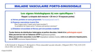 Claude EUGÈNE
MALADIE VASCULAIRE PORTO-SINUSOIDALE
Les signes histologiques b) non spécifiques 1)
Rappel: La biopsie doit mesurer > 20 mm (> 10 espaces portes)
a) Veines portales en zone périportale ("herniated portal veins")
b) Espaces vasculaires à paroi fine
Dans l'espace porte ("espace porte hypervasculaire")
En périphérie de l'espace porte ("vaisseaux péri-portaux anormaux"
c) Dilatation sinusoïdale et fibrose péri-sinusoïdale modérée
Toutes lésions de distribution hétérogène et parfois discrètes. Intérêt d'un pathologiste expert.
Elles peuvent se voir en l'absence d'HTP (hypertension portale).
Elles peuvent être associées à une HNF (hyperplasie nodulaire focale), voire à un adénome hépatocytaire,
ou un CHC (carcinome hépatocellulaire).
19
1) De Gottardi A, Sempoux C, Berzigotti A. Porto-sinusoidal vascular disorder. J Hepatol 2022;77(4):1124-1135.
(Accès libre sur internet, iconographie).
 