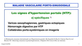 Claude EUGÈNE
MALADIE VASCULAIRE PORTO-SINUSOIDALE
Les signes d'hypertension portale (HTP):
a) spécifiques 1)
-------- --- -Varices oesophagiennes, gastriques ectopiques
Hémorragie digestive par HTP
Collatérales porto-systémiques en imagerie
21
1) Réunion de consensus internationale sur l'hypertension portale. De Franchis R, Bosch J, Garcia-Tsao G et al.
Baveno VII - Renewing consensus in portal hypertension. J Hepatol 2022 (Accès libre sur internet).
 