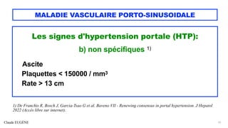 Claude EUGÈNE
MALADIE VASCULAIRE PORTO-SINUSOIDALE
Les signes d'hypertension portale (HTP):
b) non spécifiques 1)
-------- --- Ascite
Plaquettes < 150000 / mm3
Rate > 13 cm
22
1) De Franchis R, Bosch J, Garcia-Tsao G et al. Baveno VII - Renewing consensus in portal hypertension. J Hepatol
2022 (Accès libre sur internet).
 