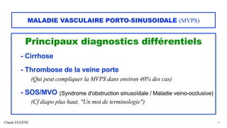 Claude EUGÈNE
MALADIE VASCULAIRE PORTO-SINUSOIDALE (MVPS)
Principaux diagnostics différentiels
- Cirrhose
- Thrombose de la veine porte
(Qui peut compliquer la MVPS dans environ 40% des cas)
- SOS/MVO (Syndrome d'obstruction sinusoïdale / Maladie veino-occlusive)
(Cf diapo plus haut, "Un mot de terminologie")
23
 