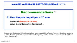 Claude EUGÈNE
MALADIE VASCULAIRE PORTO-SINUSOIDALE (MVPS)
Recommandations 1)
2) Une biopsie hépatique > 20 mm
Montrant l'absence de cirrhose,
est un élément essentiel du diagnostic
27
1)Bedossa P, Rautou PE. Maladie vasculaire porto-sinusoïdale. Hépato-Gastro et Oncologie digestive
2018;25(Suppl 2):49-54. Recommandations françaises pour les maladies vasculaires du foie (Accès
libre sur internet).
 
