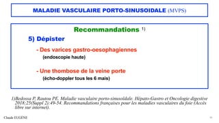 Claude EUGÈNE
MALADIE VASCULAIRE PORTO-SINUSOIDALE (MVPS)
Recommandations 1)
5) Dépister
- Des varices gastro-oesophagiennes
(endoscopie haute)
- Une thombose de la veine porte
(écho-doppler tous les 6 mais)
30
1)Bedossa P, Rautou PE. Maladie vasculaire porto-sinusoïdale. Hépato-Gastro et Oncologie digestive
2018;25(Suppl 2):49-54. Recommandations françaises pour les maladies vasculaires du foie (Accès
libre sur internet).
 