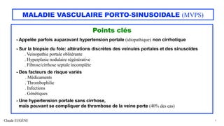 Claude EUGÈNE
MALADIE VASCULAIRE PORTO-SINUSOIDALE (MVPS)
Points clés
- Appelée parfois auparavant hypertension portale (idiopathique) non cirrhotique
- Sur la biopsie du foie: altérations discrètes des veinules portales et des sinusoïdes
. Veinopathie portale oblitérante
. Hyperplasie nodulaire régénérative
. Fibrose/cirrhose septale incomplète
- Des facteurs de risque variés
. Médicaments
. Thrombophilie
. Infections
. Génétiques
- Une hypertension portale sans cirrhose,
mais pouvant se compliquer de thrombose de la veine porte (40% des cas)
4
 