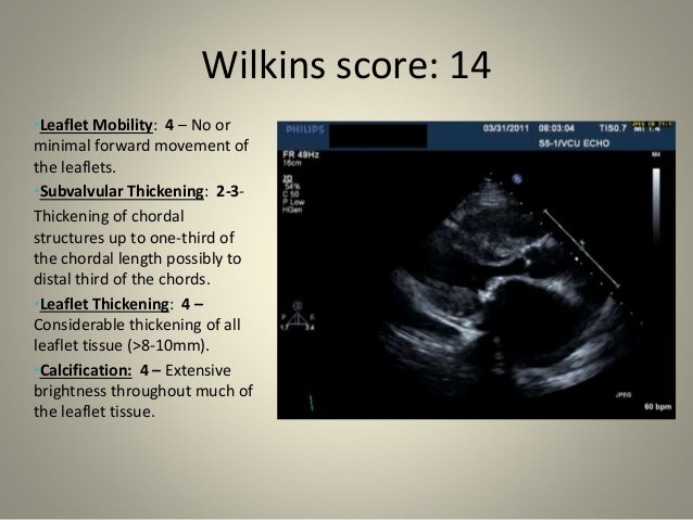 Mitral valve scoring before BMV
