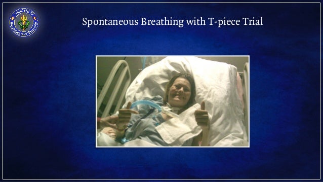 weaning mvss trial spontaneous respiratory