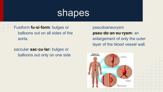 Thoracic aortic aneurysm | PPTX