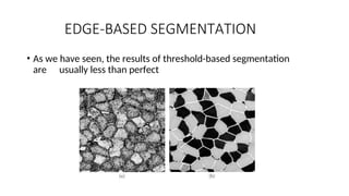 EDGE-BASED SEGMENTATION
• As we have seen, the results of threshold-based segmentation
are usually less than perfect
 