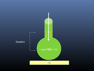 0
Auto PEEP +10-5
Gradient
-15
 