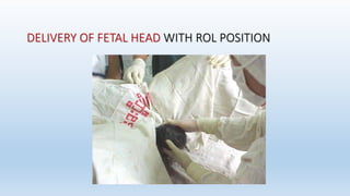 active management of labour | PPTX