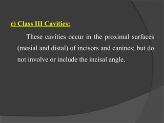 c) Class III Cavities:
These cavities occur in the proximal surfaces
(mesial and distal) of incisors and canines; but do
not involve or include the incisal angle.
 