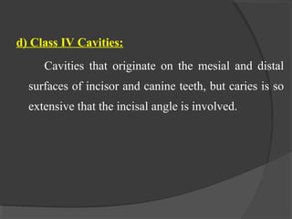 d) Class IV Cavities:
Cavities that originate on the mesial and distal
surfaces of incisor and canine teeth, but caries is so
extensive that the incisal angle is involved.
 