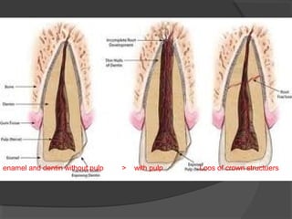enamel and dentin without pulp > with pulp Loos of crown structuers
 