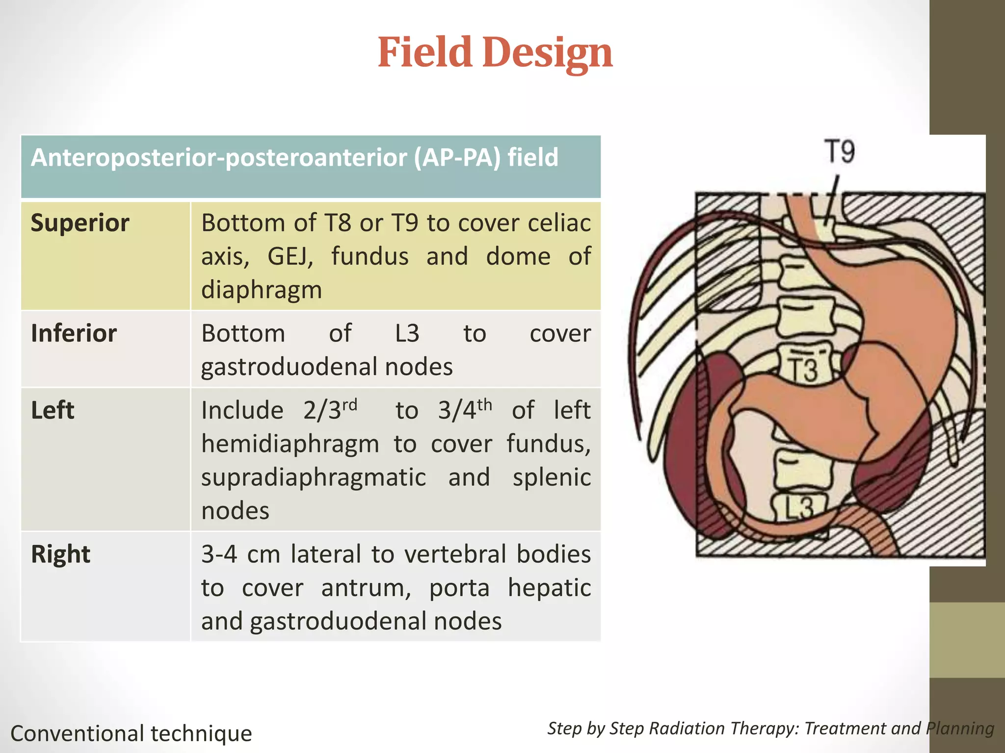 Management of gastric cancer | PPTX