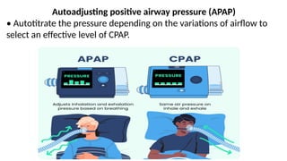 Management of obstructive sleep apnea.pptx