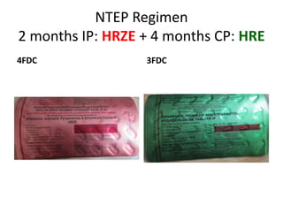 Mx of TB.pptx