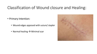 Indurated Incision Mx of Wound Healing.pptx