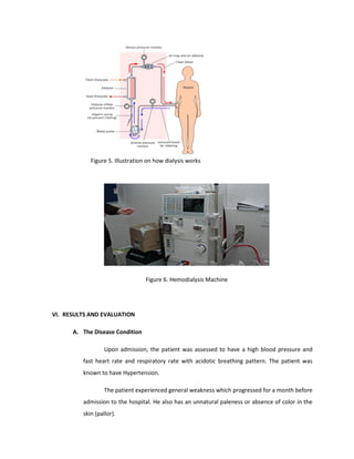 Figure 6. Hemodialysis Machine
VI. RESULTS AND EVALUATION
A. The Disease Condition
Upon admission, the patient was assessed to have a high blood pressure and
fast heart rate and respiratory rate with acidotic breathing pattern. The patient was
known to have Hypertension.
The patient experienced general weakness which progressed for a month before
admission to the hospital. He also has an unnatural paleness or absence of color in the
skin (pallor).
Figure 5. Illustration on how dialysis works
 