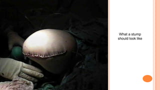 What a stump
should look like
 