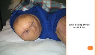 What a stump should
not look like
 